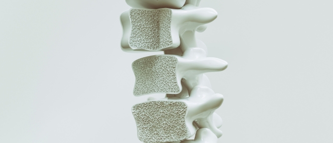 Blackmores Institute OSTEOPOROSIS Fact sheet