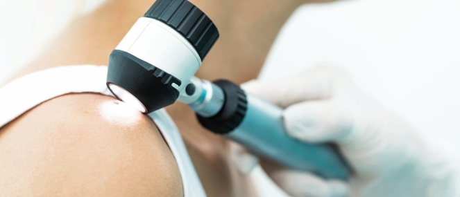 Non-melanoma skin cancer factsheet