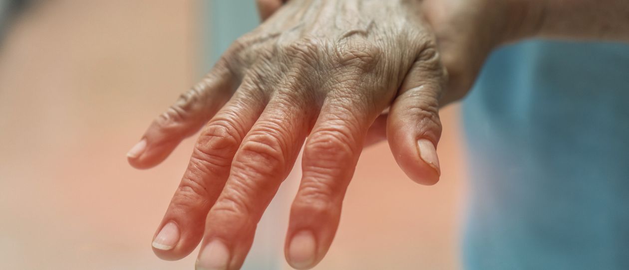 sensory nerves resulting in symptoms of tingling, numbness and burning, usually in the hands or feet.